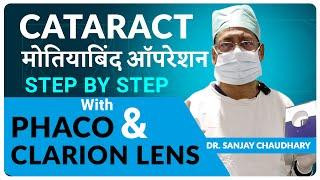 Clareon Lens Latest IOL by Alcon-USA Revolutionizing Cataract Surgery