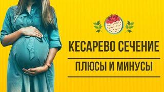 Что нужно знать о кесаревом сечении. Плюсы и минусы кесарево сечения. Дети рожденные К.С.