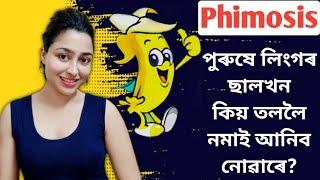 What Is Phimosis?  Tight Foreskin  Assamese Sex Education