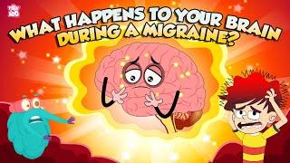 What Is a Migraine Headache?  What Happens to Your Brain During a Migraine?  The Dr Binocs Show