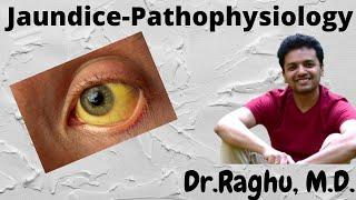 JAUNDICE - Types and Pathophysiology  Catabolism of Hemoglobin