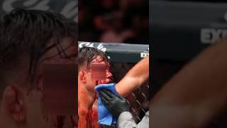 el corte en la ceja de Drew Dober #ufc #ko #ufclatino  #ufcespanol #UFCDenver #jeansilva #drewdober