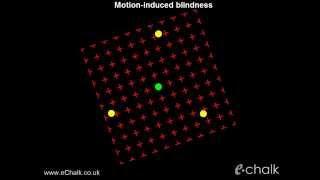 Motion-induced blindness test for the severity of ADHD  eChalk illusion