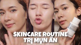 MỤN ẨN TẬP 4  SKINCARE ROUTINE DÀNH CHO DA BỊ MỤN ẨN #bha #benzoylperoxide #combinationskin