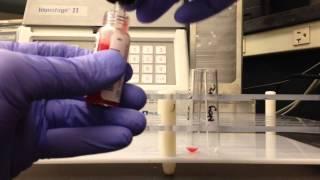 Blood Bank- A Subgroup Testing