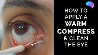 How to Apply a Warm Compress & Clean the Eye  Eye First Aid  OSCE Guide  UKMLA  CPSA