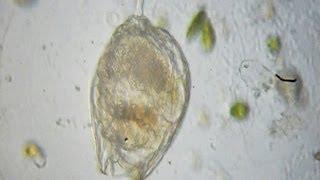 Rotifer - Lecane hamata