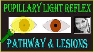 Pupillary Light Reflex – Pathway & Lesions  Neuro ophthalmology
