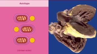 Atrofia metaplasia e displasia