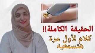 تجربتى الكاملة مع ليزر ازالة الشعر  اخطاء لازم تتفاديها