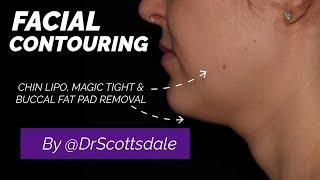 FACIAL CONTOURING - The Face Makeover by @DrScottsdale