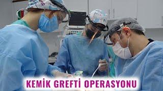 Kemik Grefti Operasyonu  Prof. Dr. Mustafa Tek