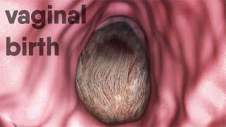 Vaginal-Birth Natural -Childbirth