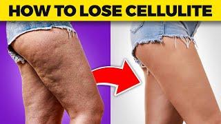 Cellulite Be Gone Dr. Bergs Expert Tips on Losing Thigh and Buttock Cellulite