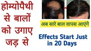 Baldness  Best medicines for hairs Regrow Explained by Dr Tarun chauhan