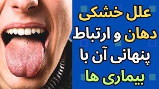 علل خشکی دهان و ارتباط پنهانی اش با بیماری ها