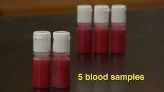 Blood Typing Exercise