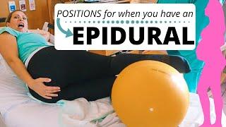 EPIDURAL  positions to speed things up