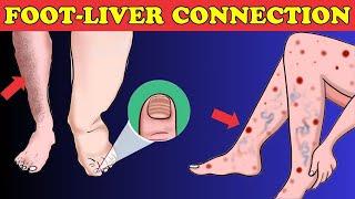 Body Alert What Your Feet Say About Your Liver Condition  Healthy Care