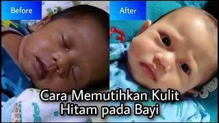 Saat Lahir Putih Lalu Kulit Bayi Menghitam  Apa Penyebabnya & Bagaimana Perawatannya  ?