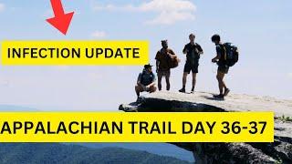 Day 36-37 Infection Update Appalachian Trail 2024 NOBO Thru Hike