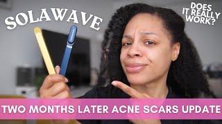 SOLAWAVE WAND TWO MONTHS LATER  Trendy Skincare Tools Worth the Hype? + Unboxing Pacifica Beauty PR