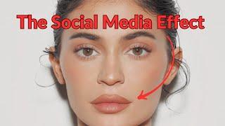 Kylie Jenner Effect Social Medias Impact on Cosmetic Surgery