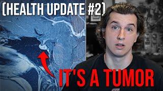 Its a tumor Health Update #2