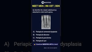 NEET MDS  INI-CET MDS  PSC  BDS - Most Important Questions  #neetmds2025 #mdsprep