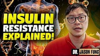 What is Insulin Resistance?  Jason Fung