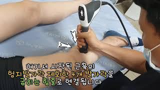 차원이 다른 족저근막염 체외충격파치료