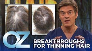 New Breakthroughs for Thinning Hair  Oz Health