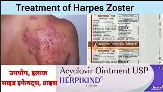Treatment of Herpes Zoster। Brutaflam MR4। Harpikind Ointment। Harpikind 400 mg।