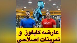 بدنسازیعارضه کایفوز و تمرینات اصلاحی