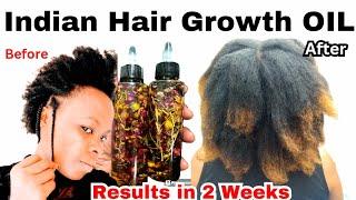 The Most Potent DIY Hair Oil For Faster Hair Growthgrow thicker and Longer HairAlopecia