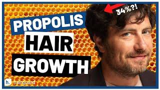 PROPOLIS For Hair Growth? Should You Try It In 2020?