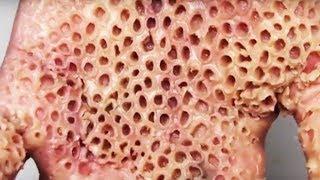 The Most Annoying Pictures Compilation  By REDDIT 5050  Trypophobia WARNING GROSS