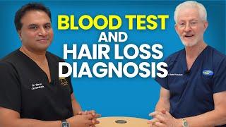 Relevance Blood and Saliva Tests in Managing Hair Loss