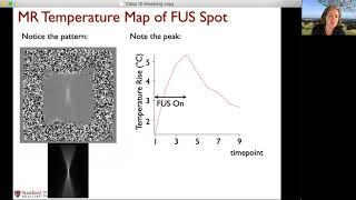 Ultrasound temperature modeling in the brain