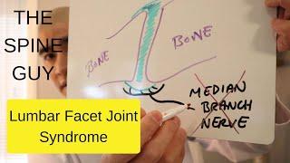 Lumbar Facet Joint Syndrome