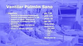 Taller de Ventilación Mecánica 3.1 Inicio de Ventilación Mecánica en pacientes con pulmón sano