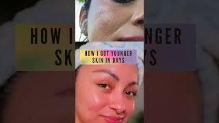 PART 1 Say goodbye to textured skin  Mirenesse Australia #skincareroutine #acnetreatment #acne