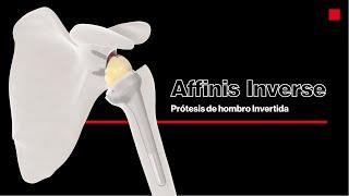 AFFINIS® INVERSE  Prótesis de hombro invertida