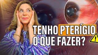 Como Prevenir e Tratar o Pterígio nos Olhos?