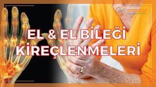 EL VE El BİLEĞİ KİREÇLENMELERİ