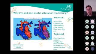 Care of the Neonate with Diagnosis of PPHN - Nursing Perspective - Mathew Buckle Neonates