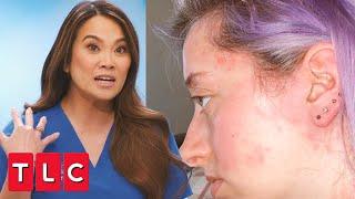 Dr. Lee Sees a Patient With Mast Cell Disease  Dr. Pimple Popper