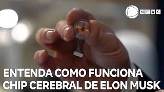 Entenda como funciona o chip cerebral da empresa de Elon Musk