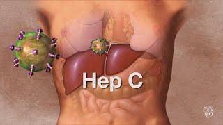 Mayo Clinic Minute ABCs of hepatitis