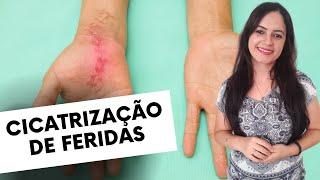 Cicatrização de Feridas Tipos e Fases da Cicatrização Normal - Profª Juliana Mello